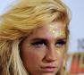 Ke$ha Photo